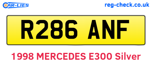 R286ANF are the vehicle registration plates.